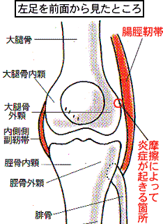 tyoukeijintai02