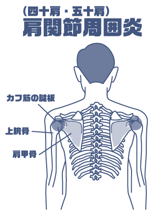 cEc2xrA3Jp