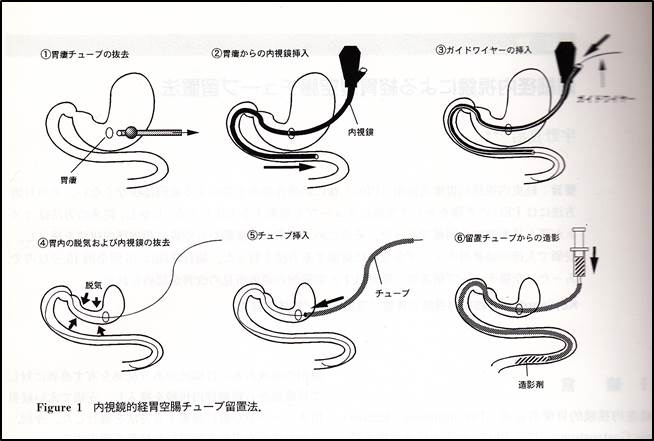 空腸 Jejunum JapaneseClass.jp