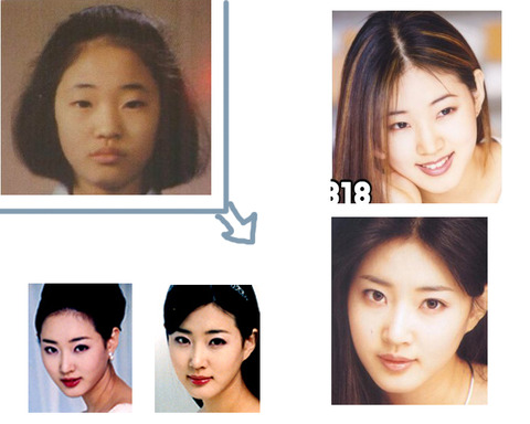整形美人3