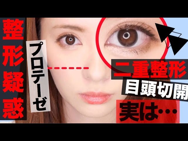 みきぽん 整形 わたしが今までしてきたこと Youtuberコメ速報