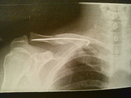 Image_2072011
