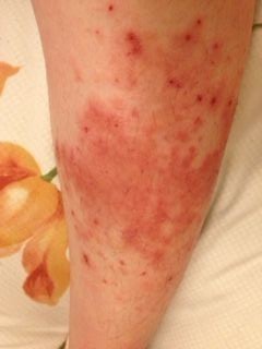 20120217_左足