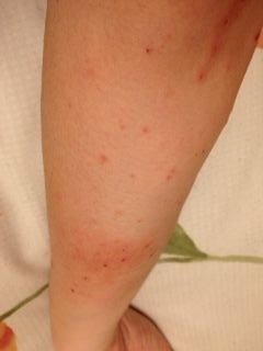 20120217_左腕_裏