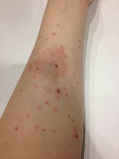 20120208_左腕