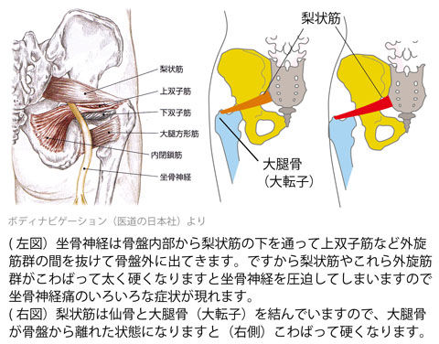 梨状筋と坐骨神経2