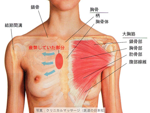 大胸筋の損傷