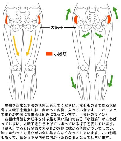 小殿筋のこわばりとO脚
