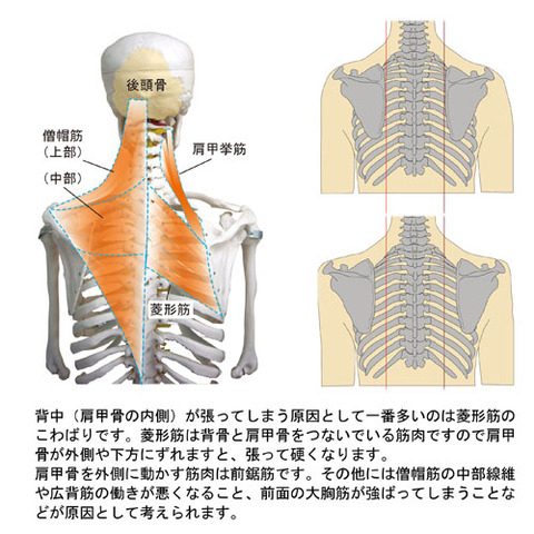 背中(菱形筋)のハリ