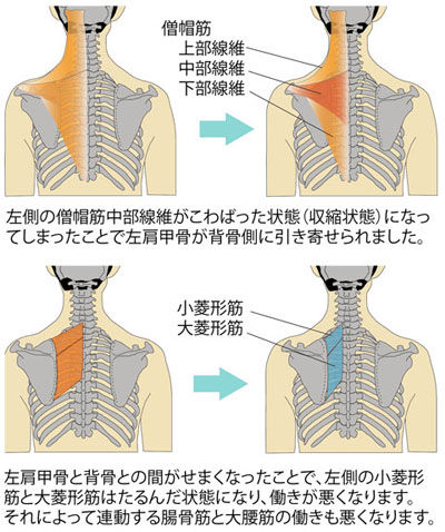 中部僧帽筋「こ」による菱形筋の「ゆ」