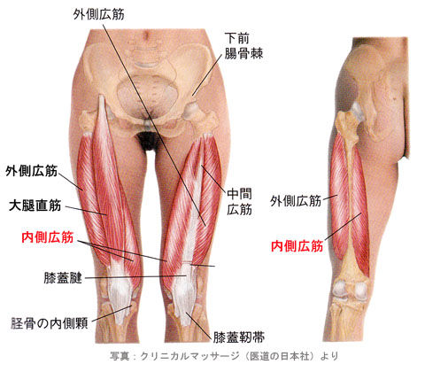 内側広筋