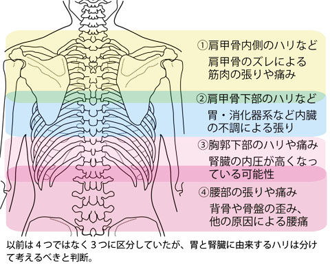 背中の張りや痛みの原因区分2