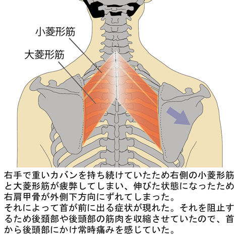 菱形筋の「ゆ」による肩甲骨の「ド」