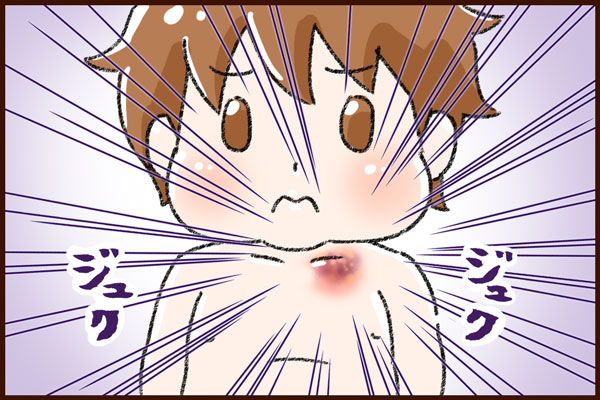 ゼクシィBaby みんなの体験記 ゆむい