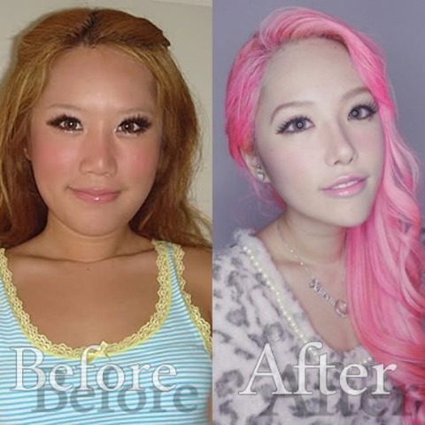 surgery-fail-25