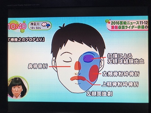 椿隆之 (2)