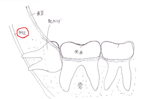 無