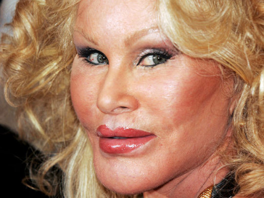 Jocelyn-Wildenstein-5176301_1_540x405