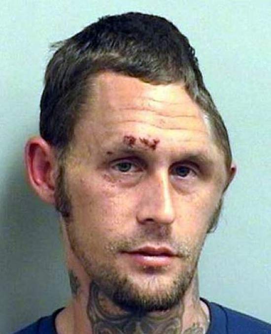 missing-part-of-head-skull-crazy-funny-mugshots