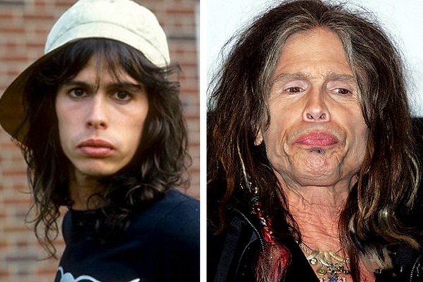 drugs-vs-celebs-before-after-09