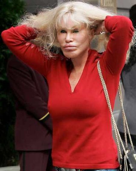 jocelyn_wildenstein-bride-of-wildenstein