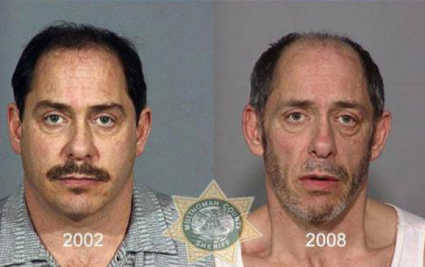 Before-And-After-Drugs-8