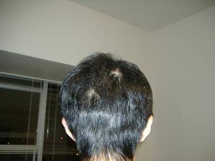 ワイ 髪のセットが下手すぎる ペンポンパン誤報 ワイ 髪のセットが下手すぎる ペンポンパン誤報