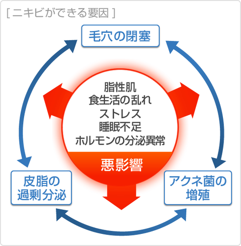 ニキビはなぜできる?