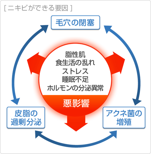 ニキビはなぜできる？