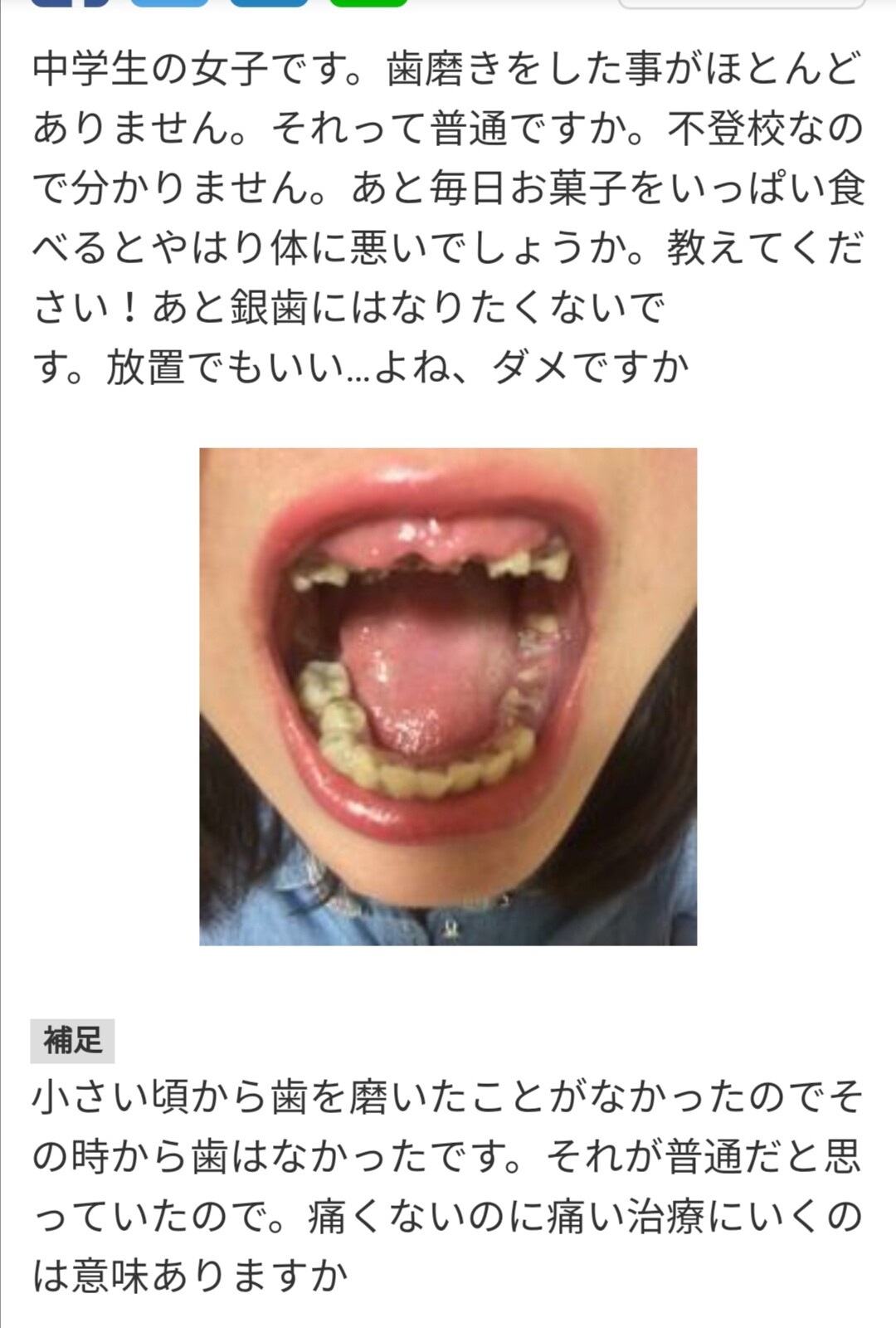 画像 Jkニート 初めて歯医者に行くｗｗｗｗｗｗｗｗｗｗｗｗｗｗ 女子アナお宝画像速報 5chまとめ