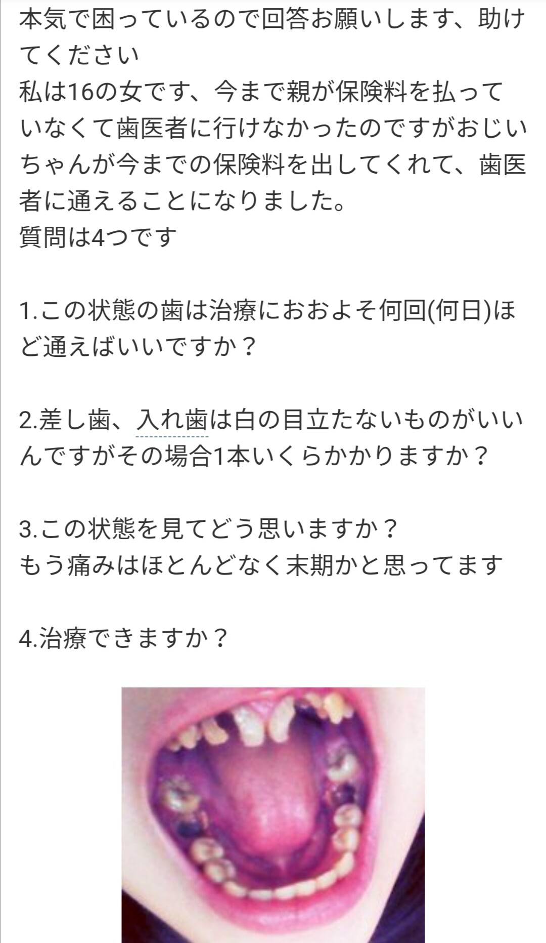 画像 Jkニート 初めて歯医者に行くｗｗｗｗｗｗｗｗｗｗｗｗｗｗ 女子アナお宝画像速報 5chまとめ