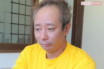 いしだ壱成が植毛