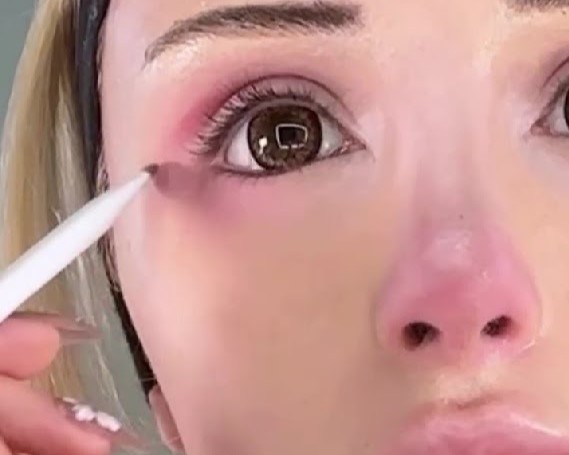 【画像】アメリカ人女性が地雷系メイクをしたら衝撃的な結果にwwwww