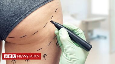 尻を整形した女性