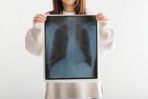 【画像】父親「娘のレントゲン、エロすぎるだろ…」