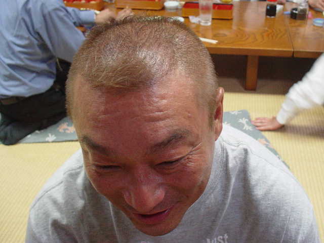 芸能人のハゲ 薄毛さんいらっしゃ い