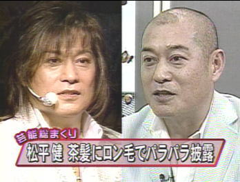 松平健 カツラのかぶりすぎで 芸能人のハゲ 薄毛さんいらっしゃ い