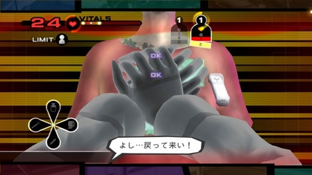 51