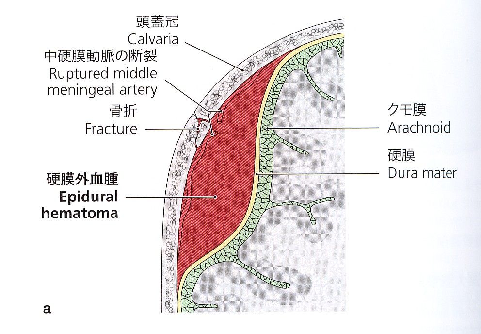 13年04月 フィニッシュ カイロ 脳身研究所のblog 13年04月 フィニッシュ カイロ 脳身研究所のblog