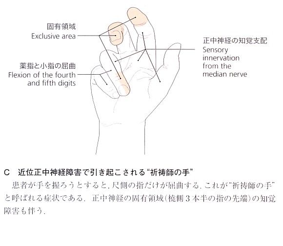 11年06月07日 フィニッシュ カイロ 脳身研究所のblog 11年06月07日 フィニッシュ カイロ 脳身研究所のblog