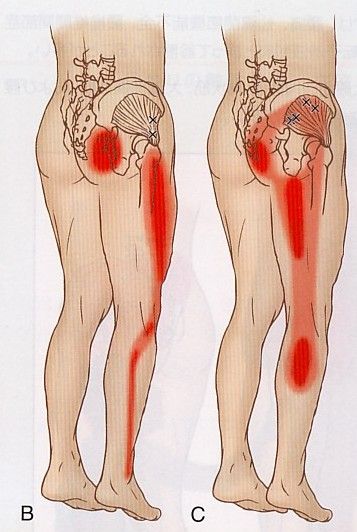 その他の病気 フィニッシュ カイロ 脳身研究所のblog その他の病気 フィニッシュ カイロ 脳身研究所のblog