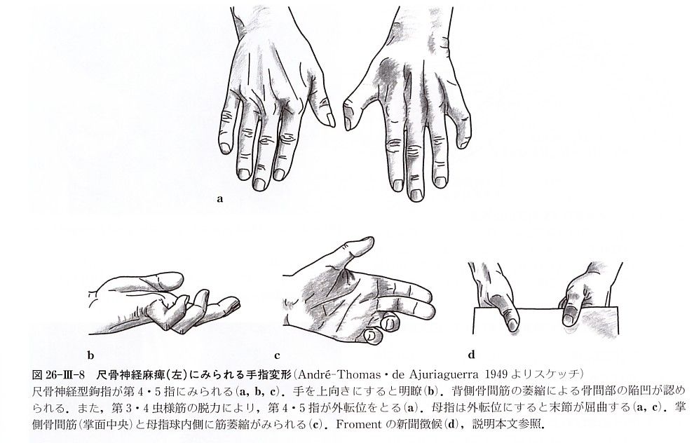 肩 肘 手 指 フィニッシュ カイロ 脳身研究所のblog 肩 肘 手 指 フィニッシュ カイロ 脳身研究所のblog