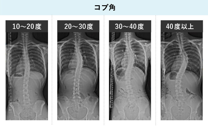 年05月18日 フィニッシュ カイロ 脳身研究所のblog 年05月18日 フィニッシュ カイロ 脳身研究所のblog