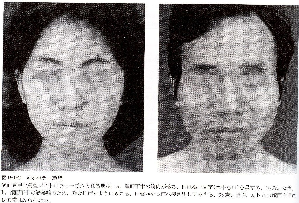 顔貌 疾患