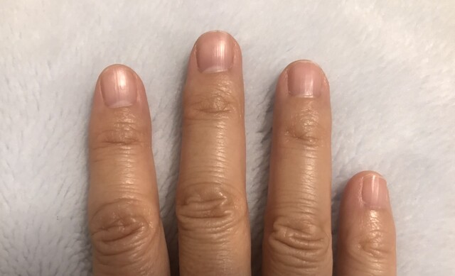 治っていたヘバーデン結節 初診から6年8ヶ月 一般職ズッキー の楽しいこと日記 パート1