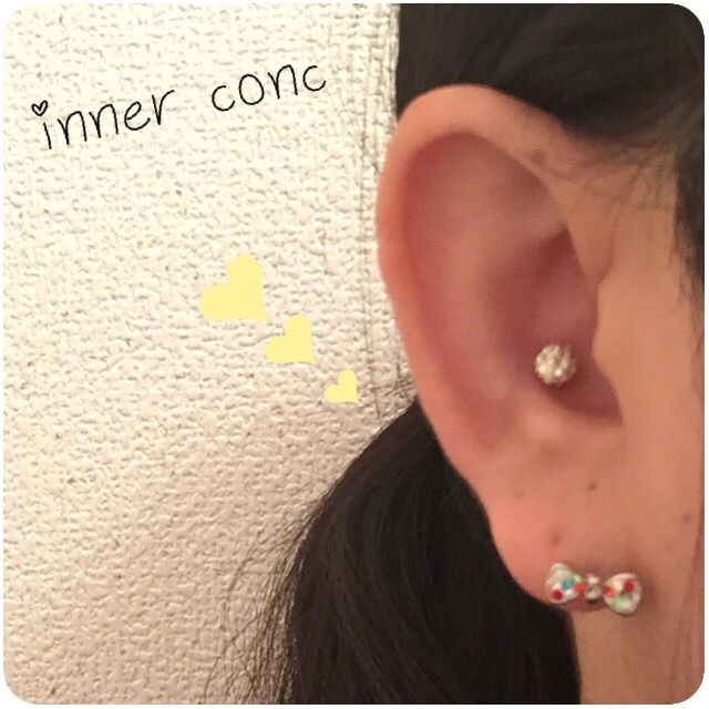 インナーコンク ニードル セルフ アーニャの日記