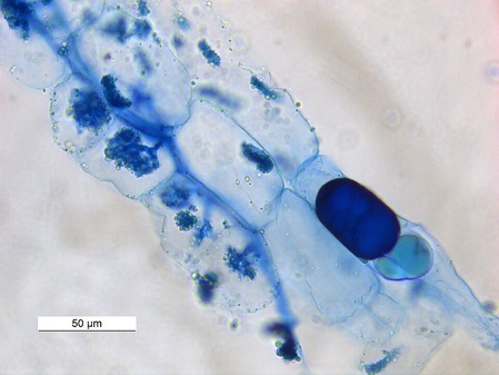 Vesicular_Arbuscular_Mycorrhizae_40X0031_03