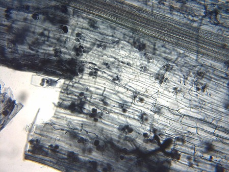 Arbuscular_mycorrhiza_microscope