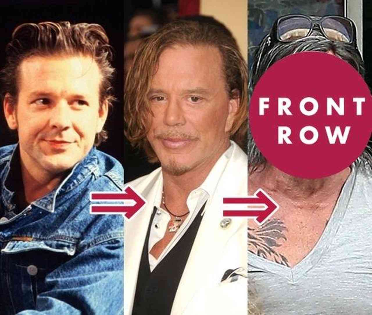 閲覧微注意 ミッキー ロークがまた整形 手術直後の写真を公開 ガールズちゃんねる