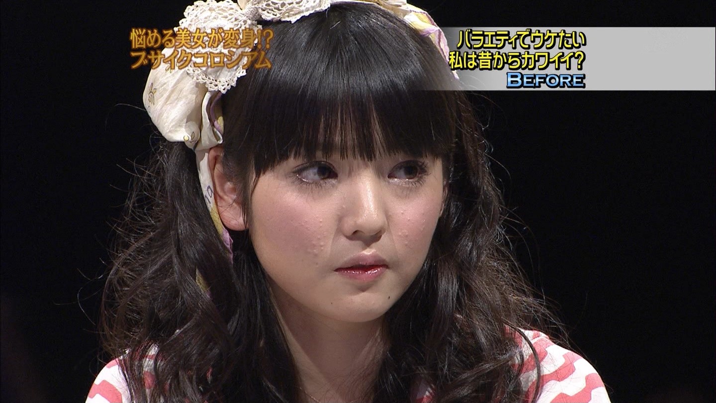 道重さゆみ めちゃイケ 肌荒れ キャプ茶